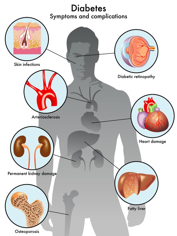 Diabetic Vascular Disease Treatment In Israel D R A Medical